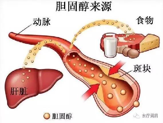 总胆固醇高6.5的严重性解析及应对策略