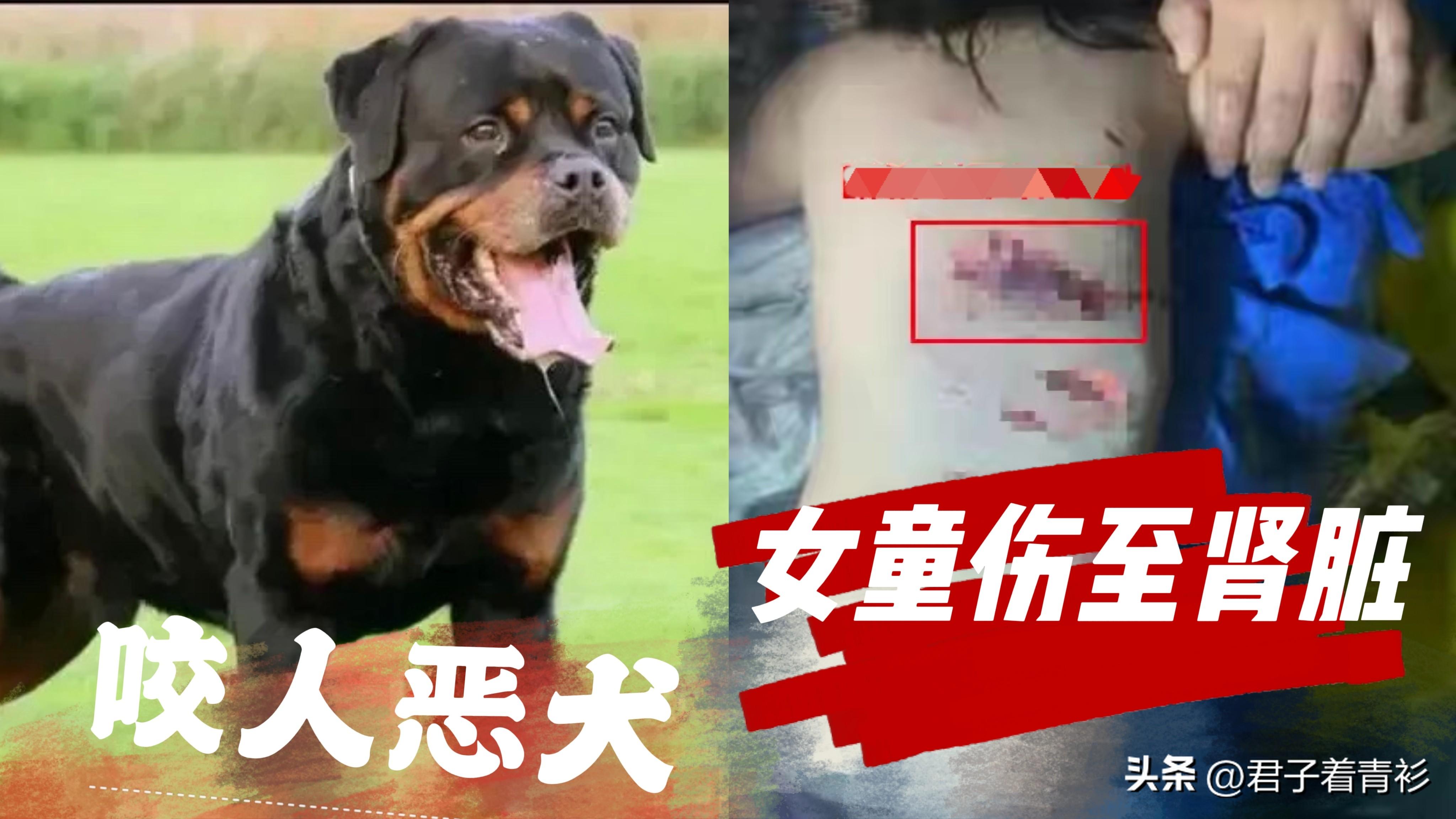 母女遭恶犬袭击生死瞬间，人间真情显光辉