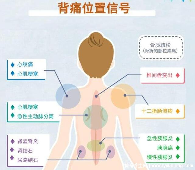 女性后背疼痛位置图与成因解析