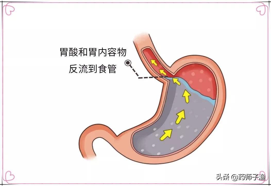 奥美拉唑副作用详解，深度解析、症状应对建议