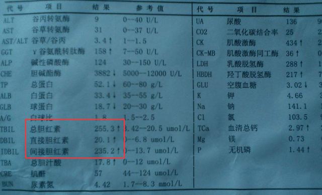 直接胆红素正常值范围与重要性解析